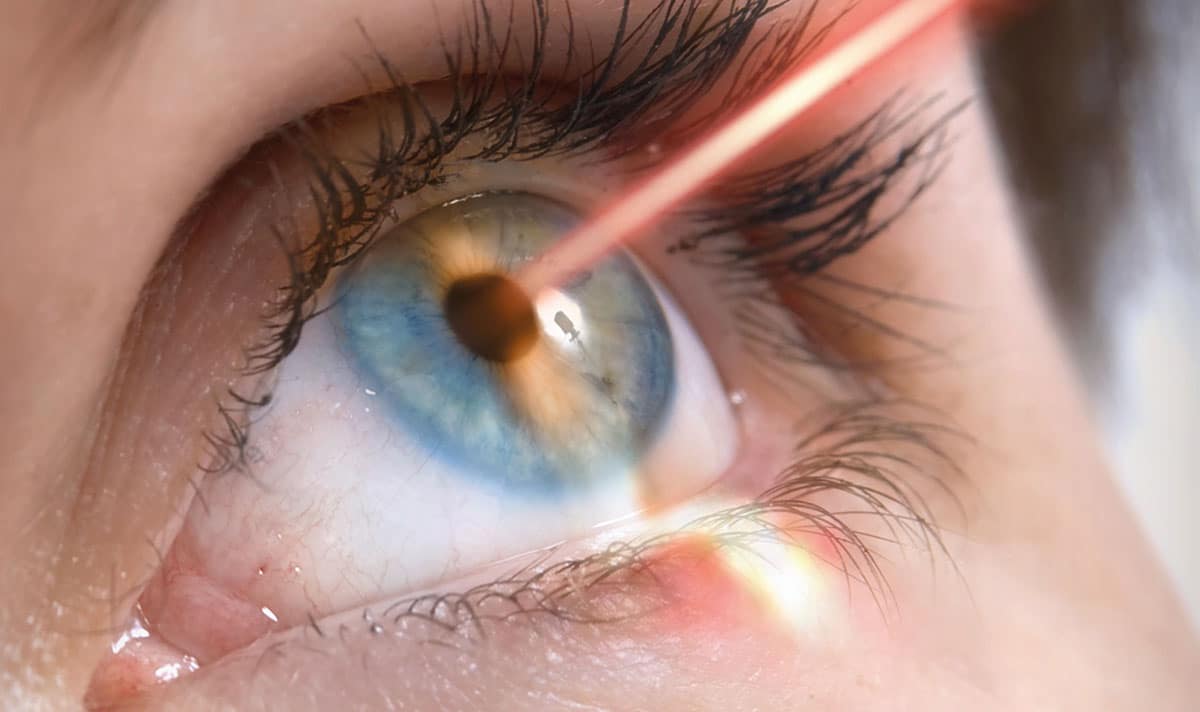 Як відбувається операція LASIK